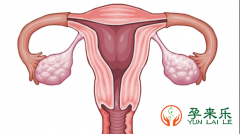 宫腔黏连不容易怀孕，试管能助孕成功吗？