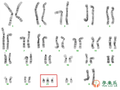 什么是染色体异常？染色体异常可以做三代试管吗？