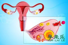 输卵管堵塞等级有几种？输卵管堵塞的治疗方法有哪几种？