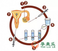 2023年去马来西亚做试管流程是什么？