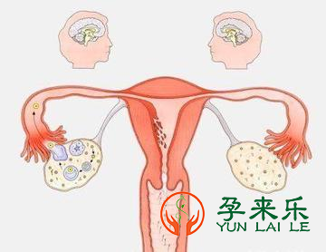 什么是卵巢早衰？怎样预防卵巢早衰？